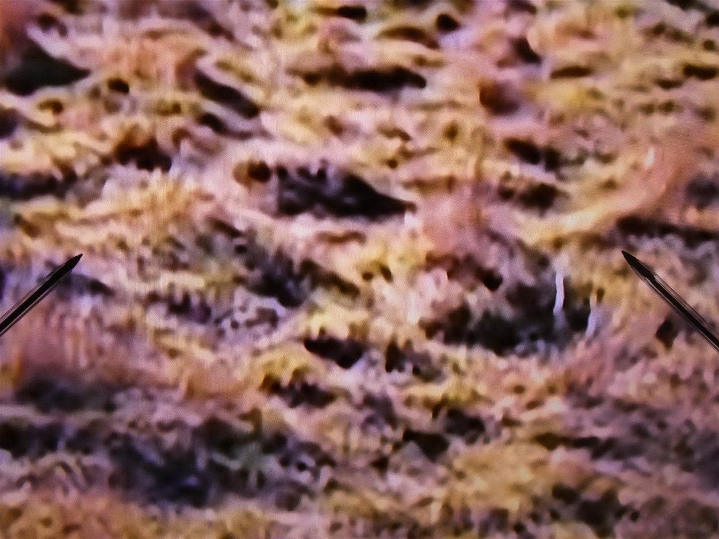 8087019